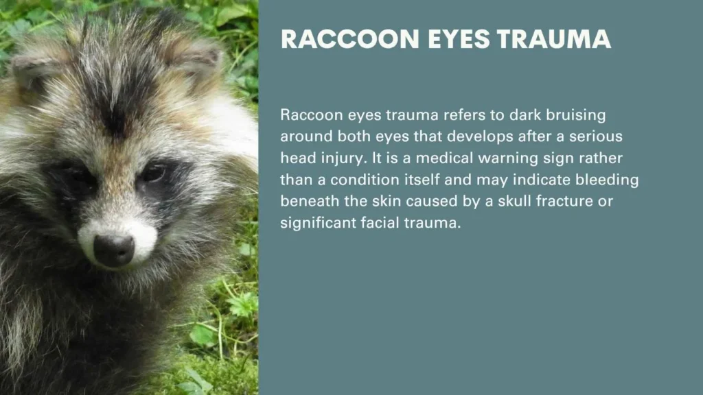 Raccoon Eyes Trauma