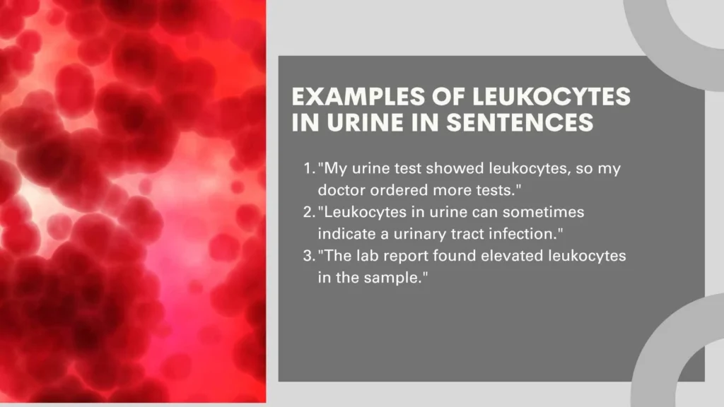 Examples of Leukocytes in Urine in Sentences