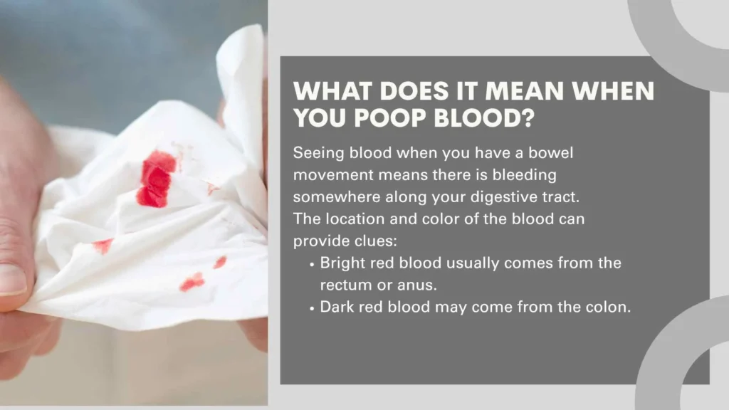 What Does It Mean When You Poop Blood?